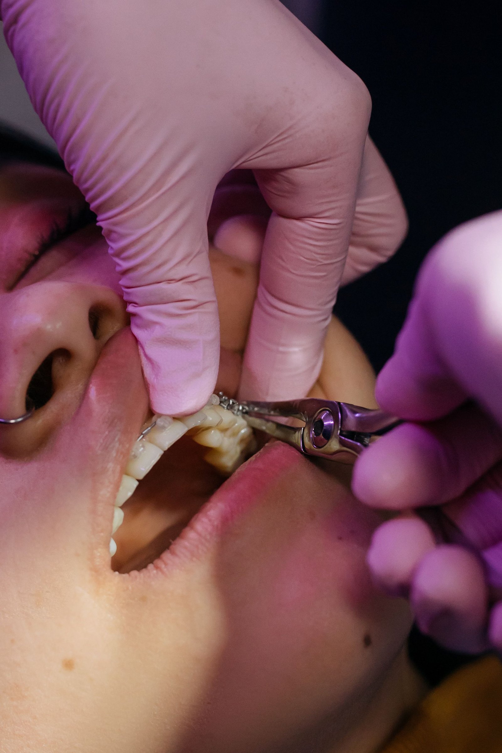 Dental IMF in Varanasi