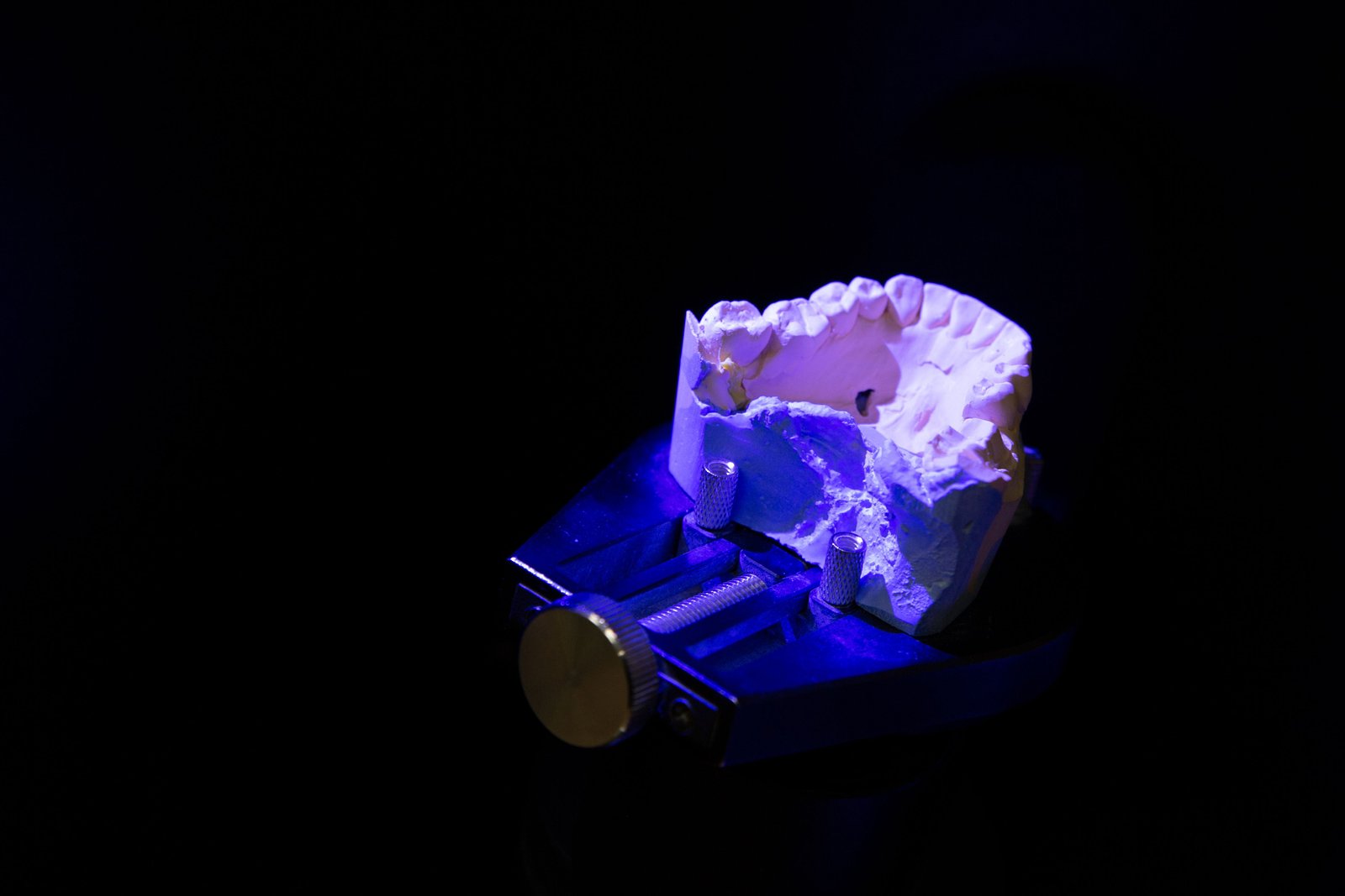 Palatal Obturator