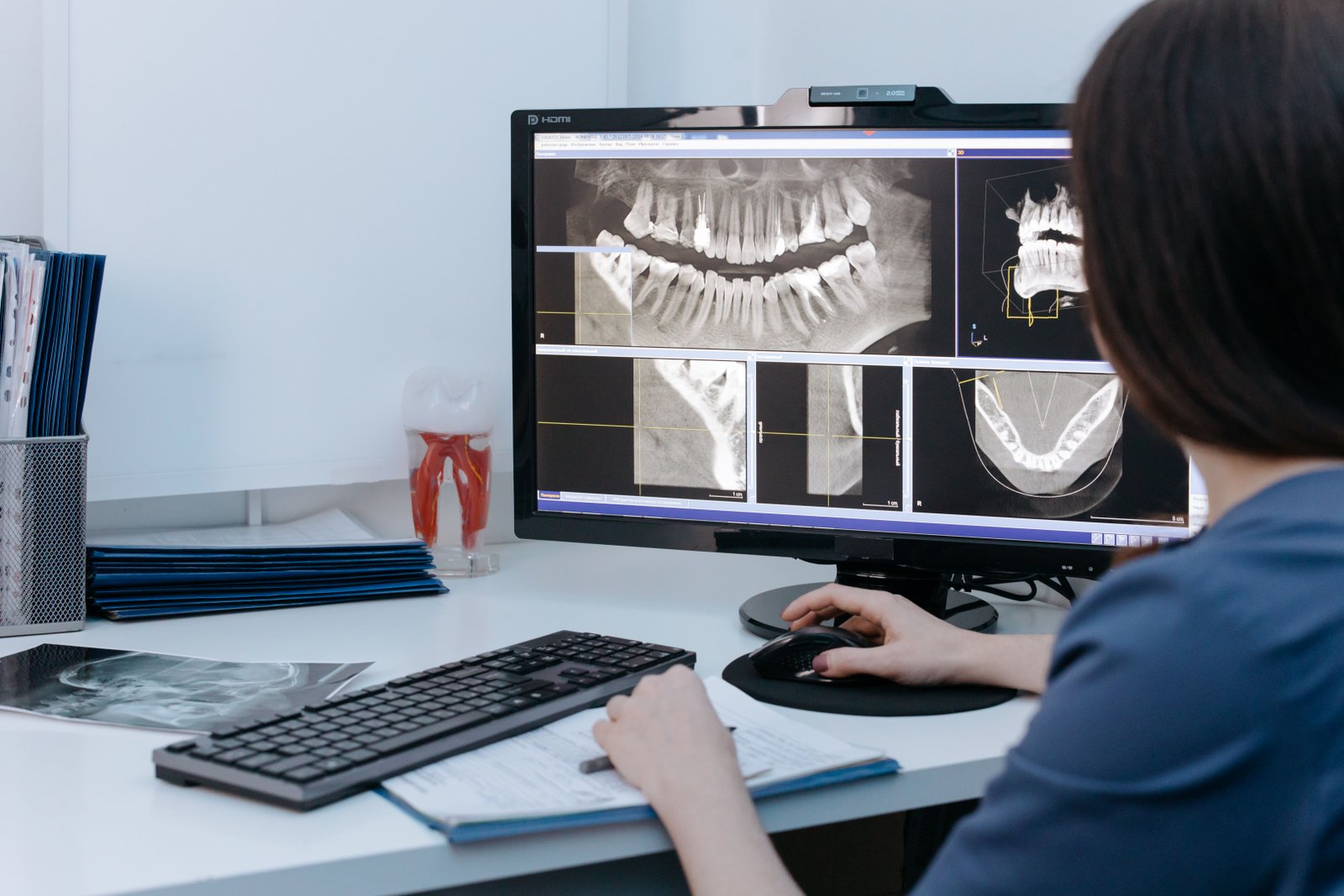 Advanced Dental Microscope and CBCT scan technology