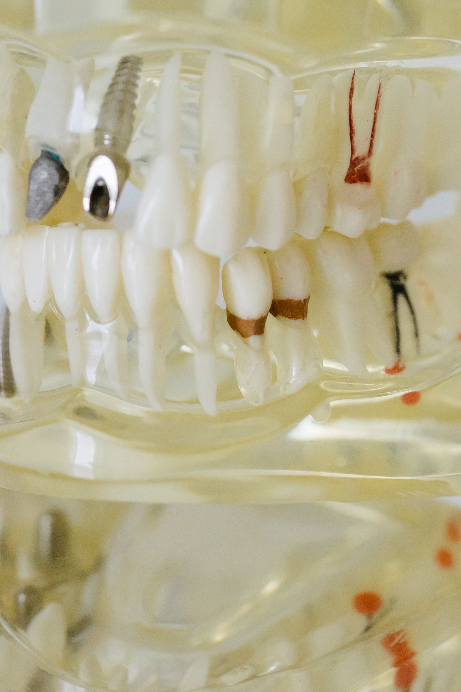 Clinical imagery of a periapical infection