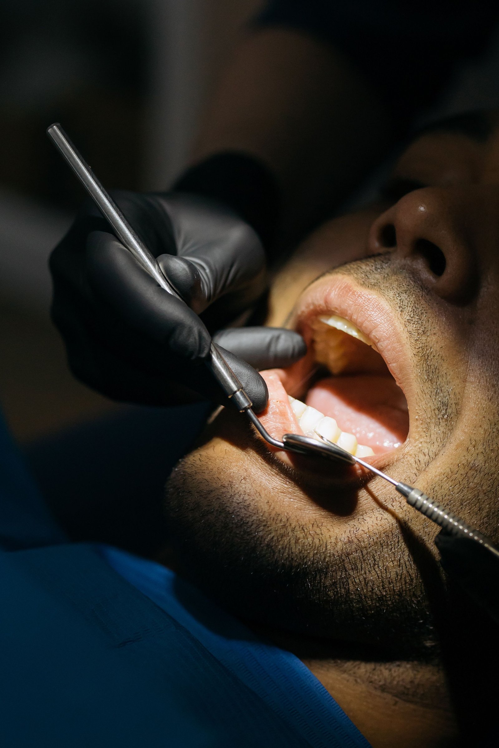 Dental fillings in Varanasi