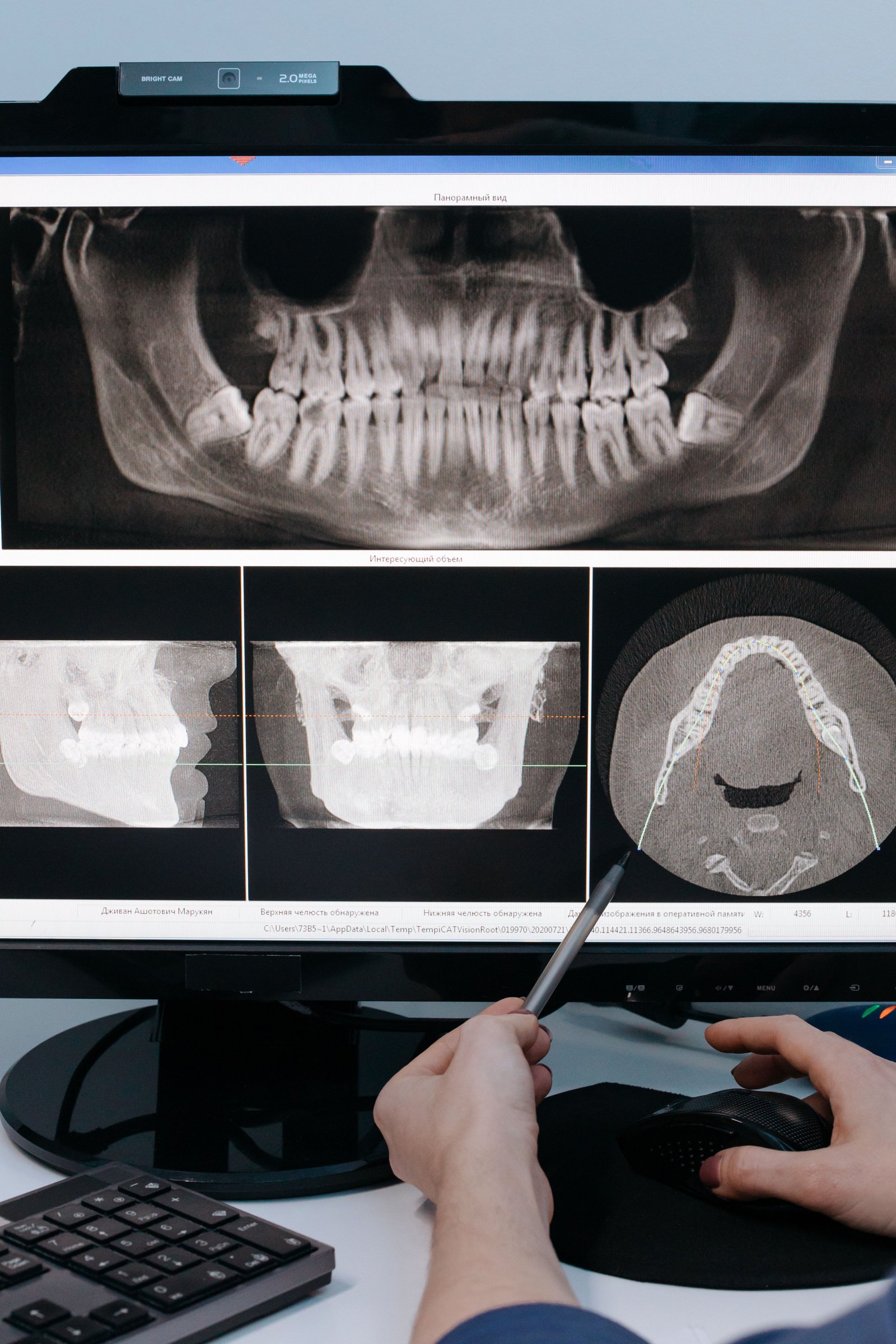 Clinical radiograph imagery of jaw fracture surgery
