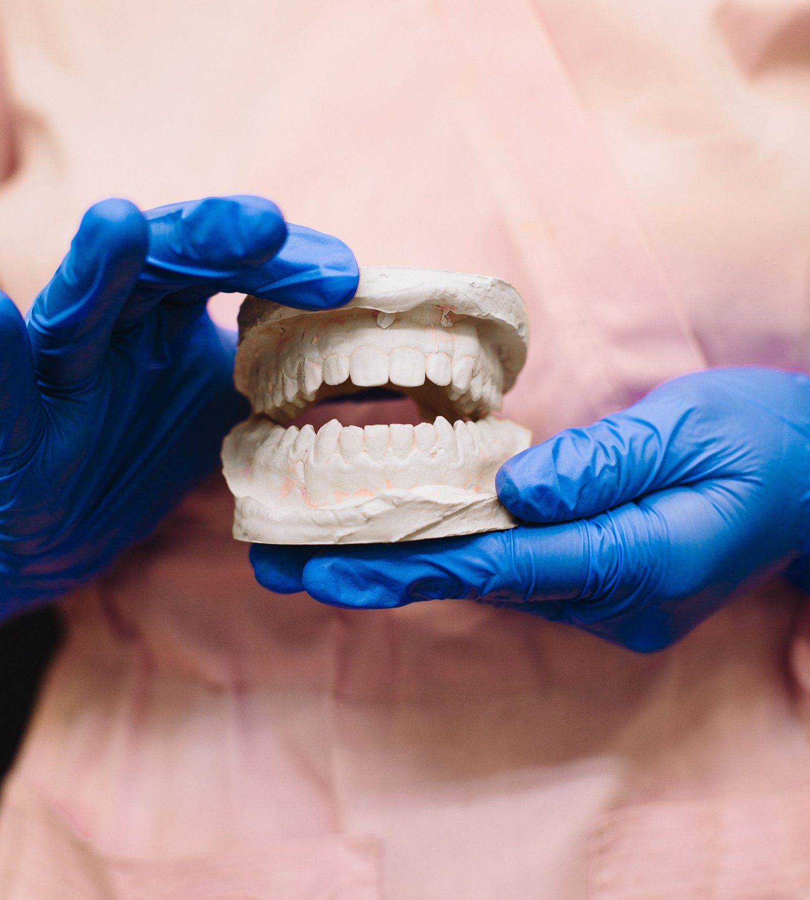 Dental Implants in Varanasi