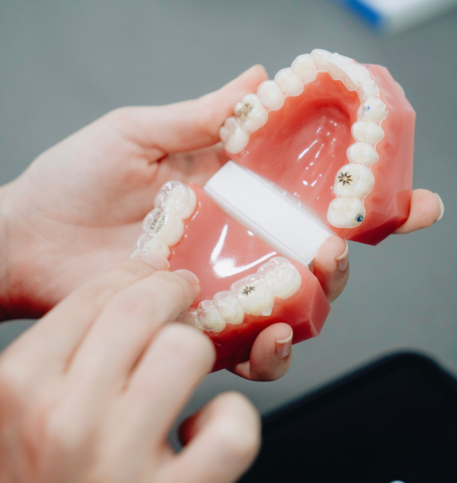 Dental Implants in Varanasi