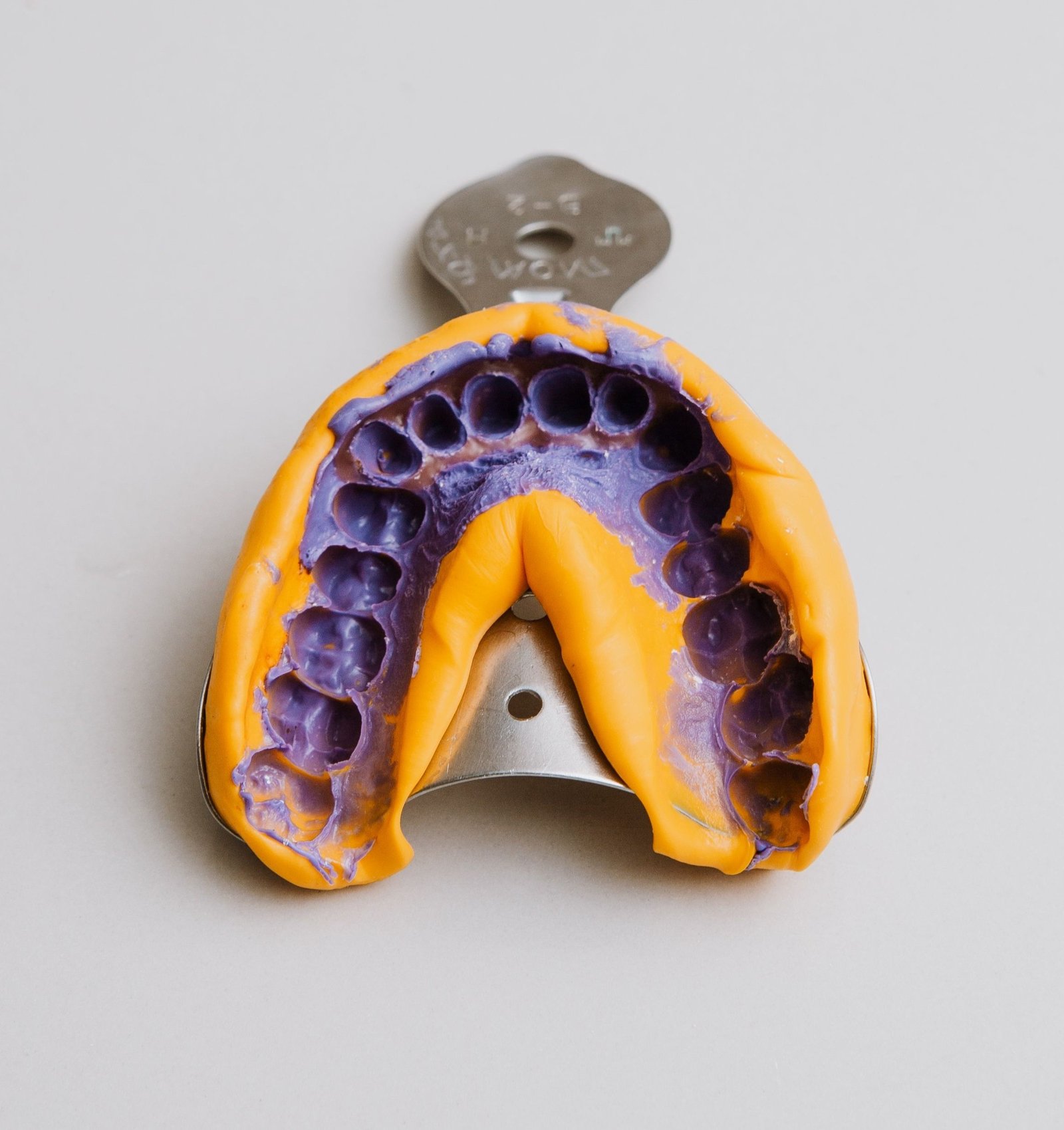 Dental Implants in Varanasi