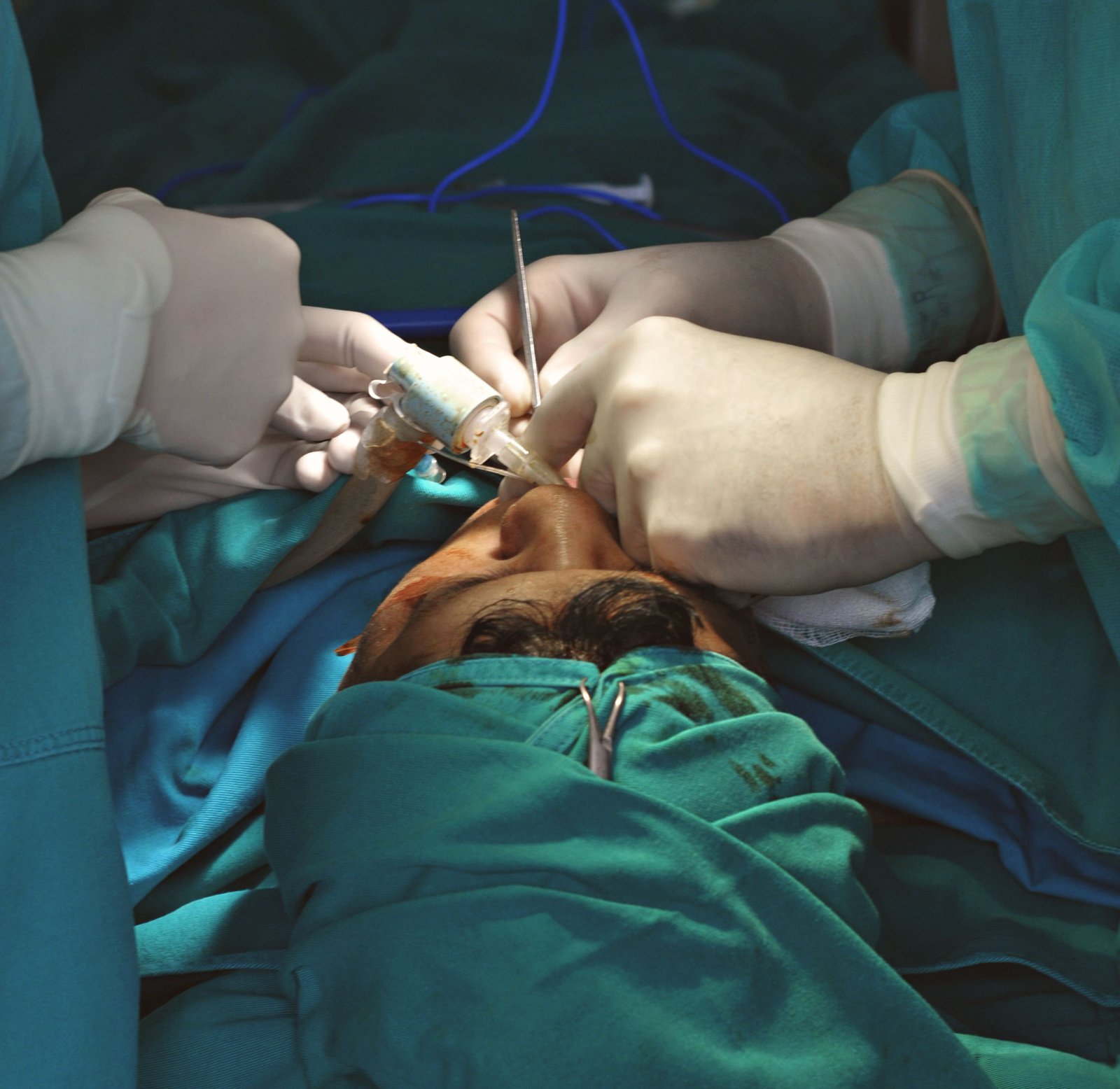 Clinical imagery of a maxillofacial prosthesis