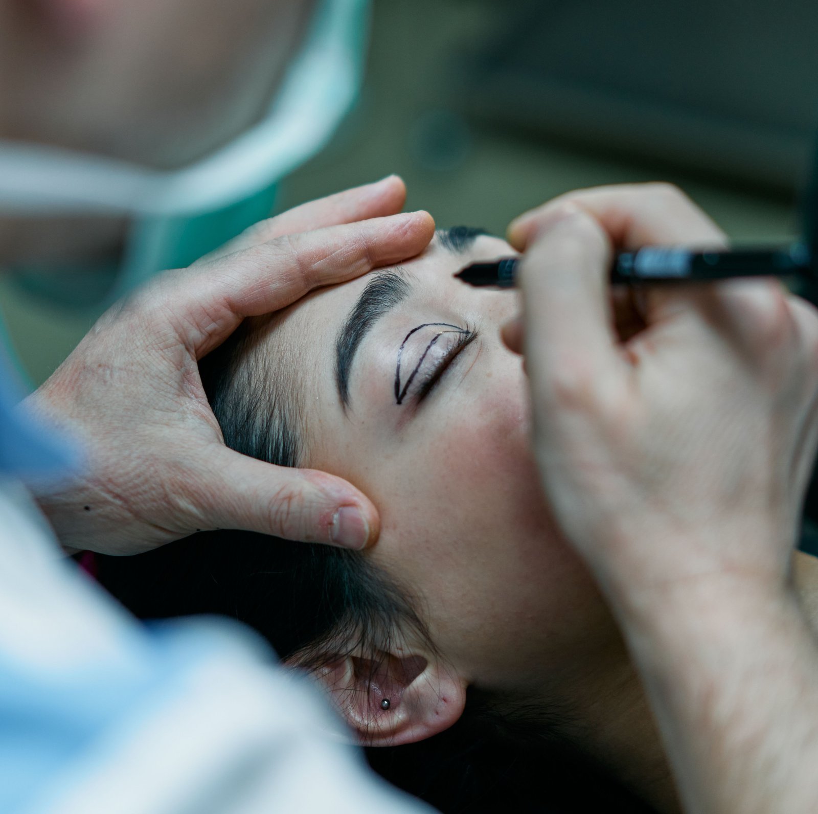 Ocular Prosthesis in Varanasi