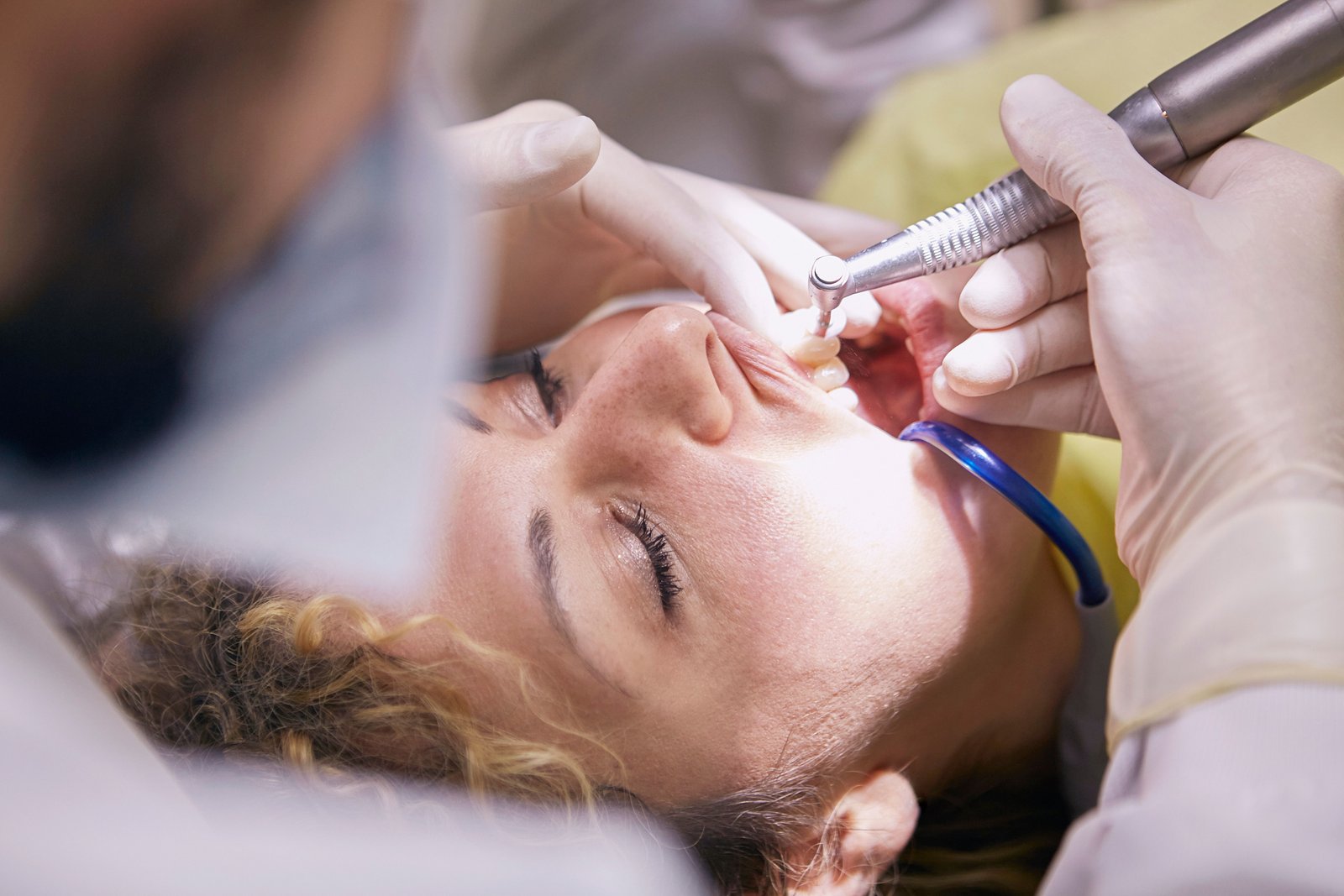 Clinical imagery of oral cavity examination for OSMF