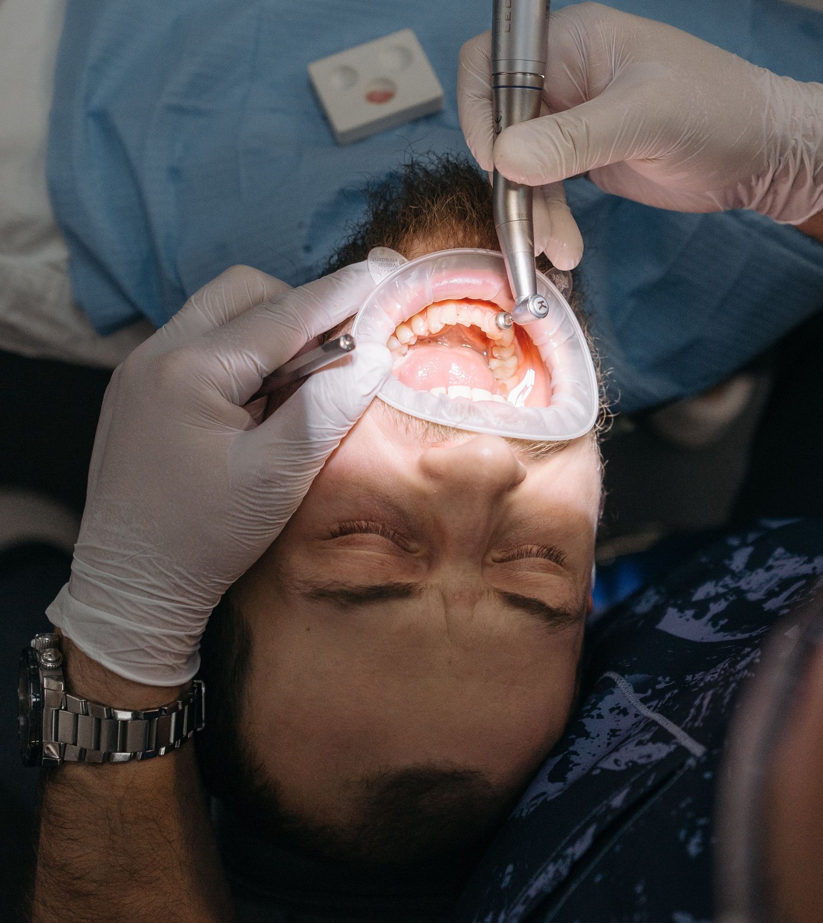 Oral Cancer Prosthesis in Varanasi