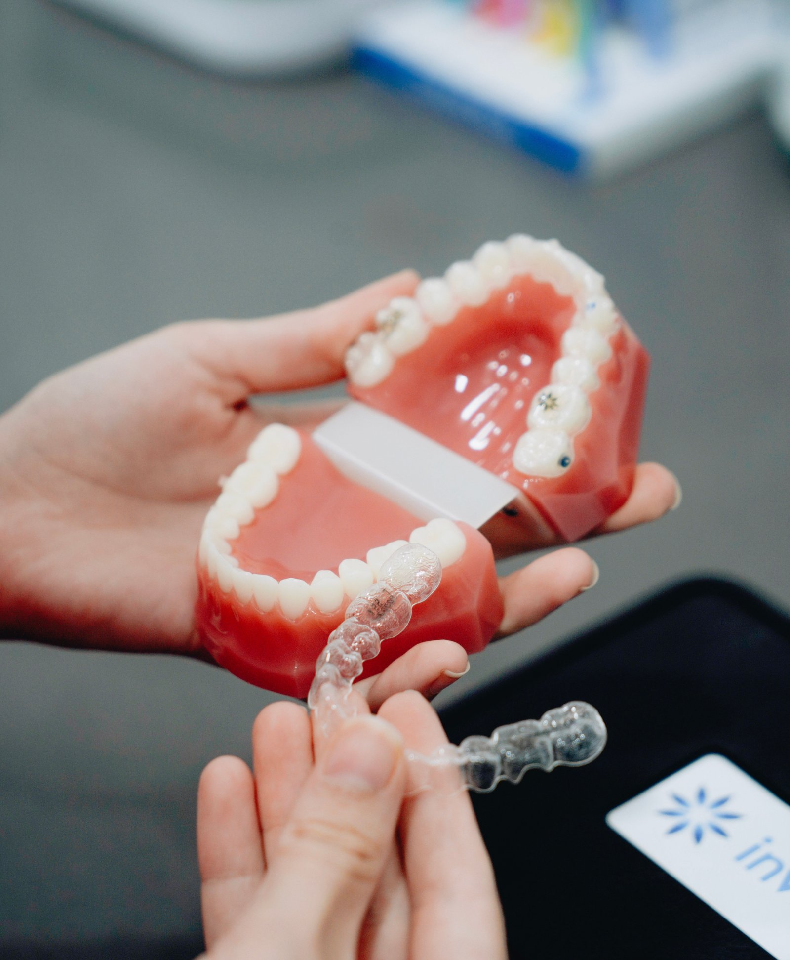 Dental Implants in Varanasi