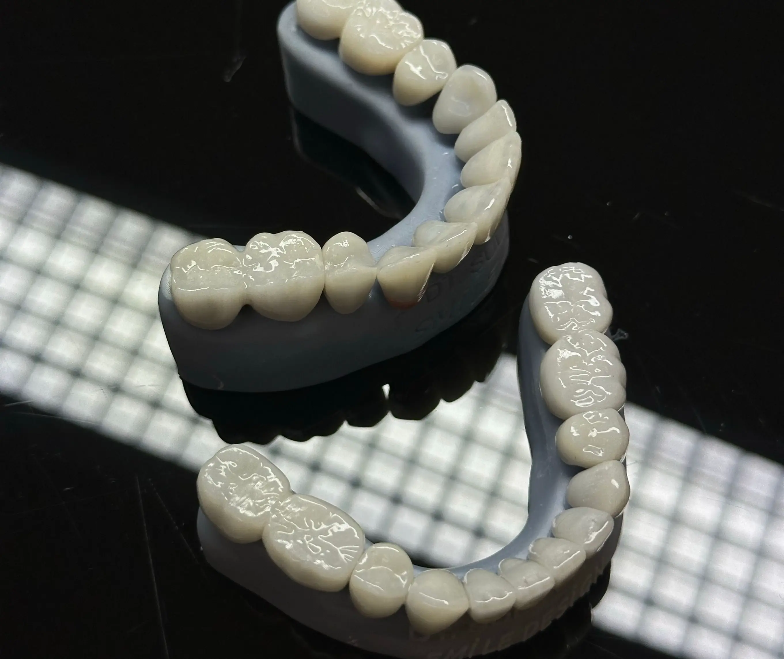 Fixed Prosthesis