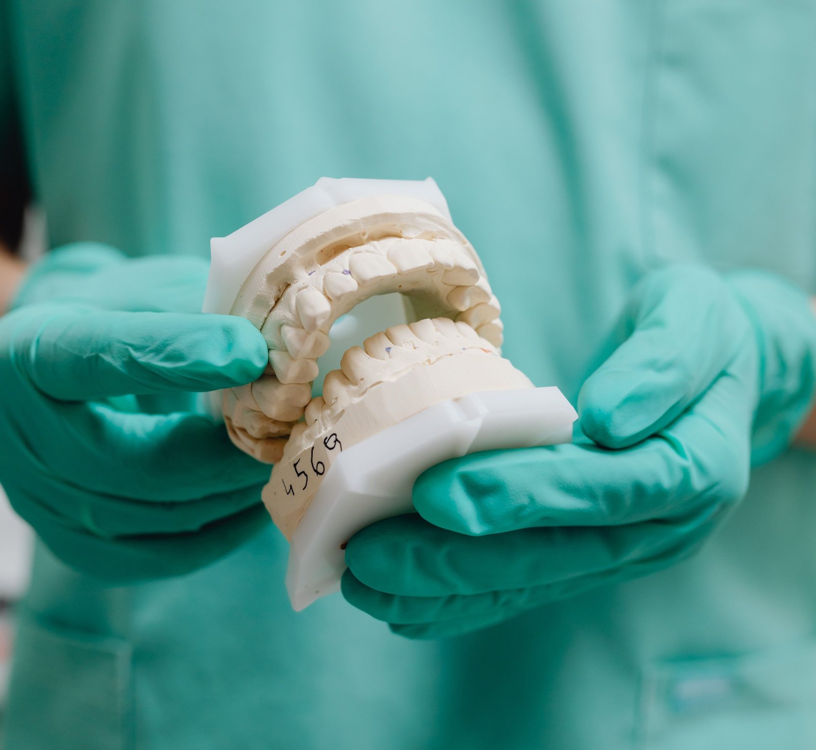 Dental Implants in Varanasi