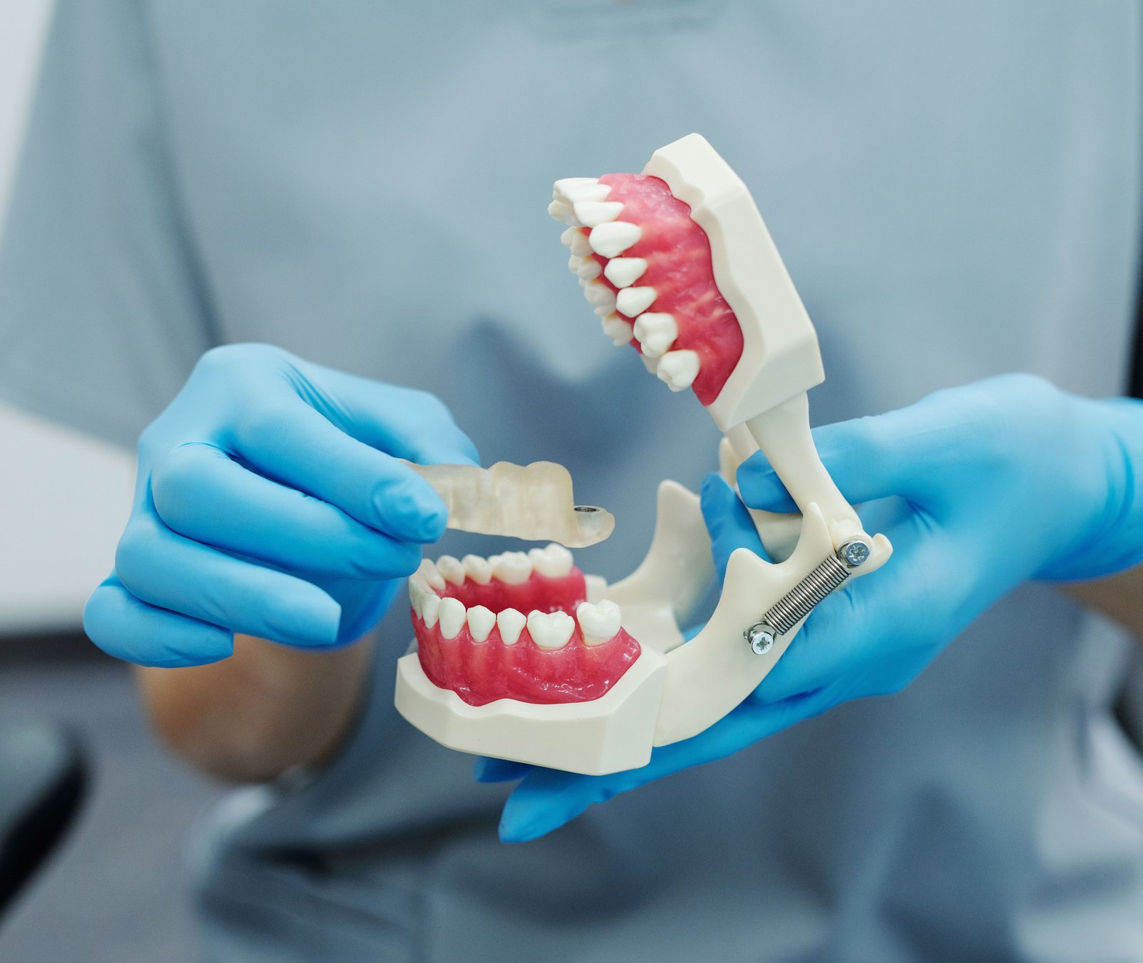 Dental Implants in Varanasi