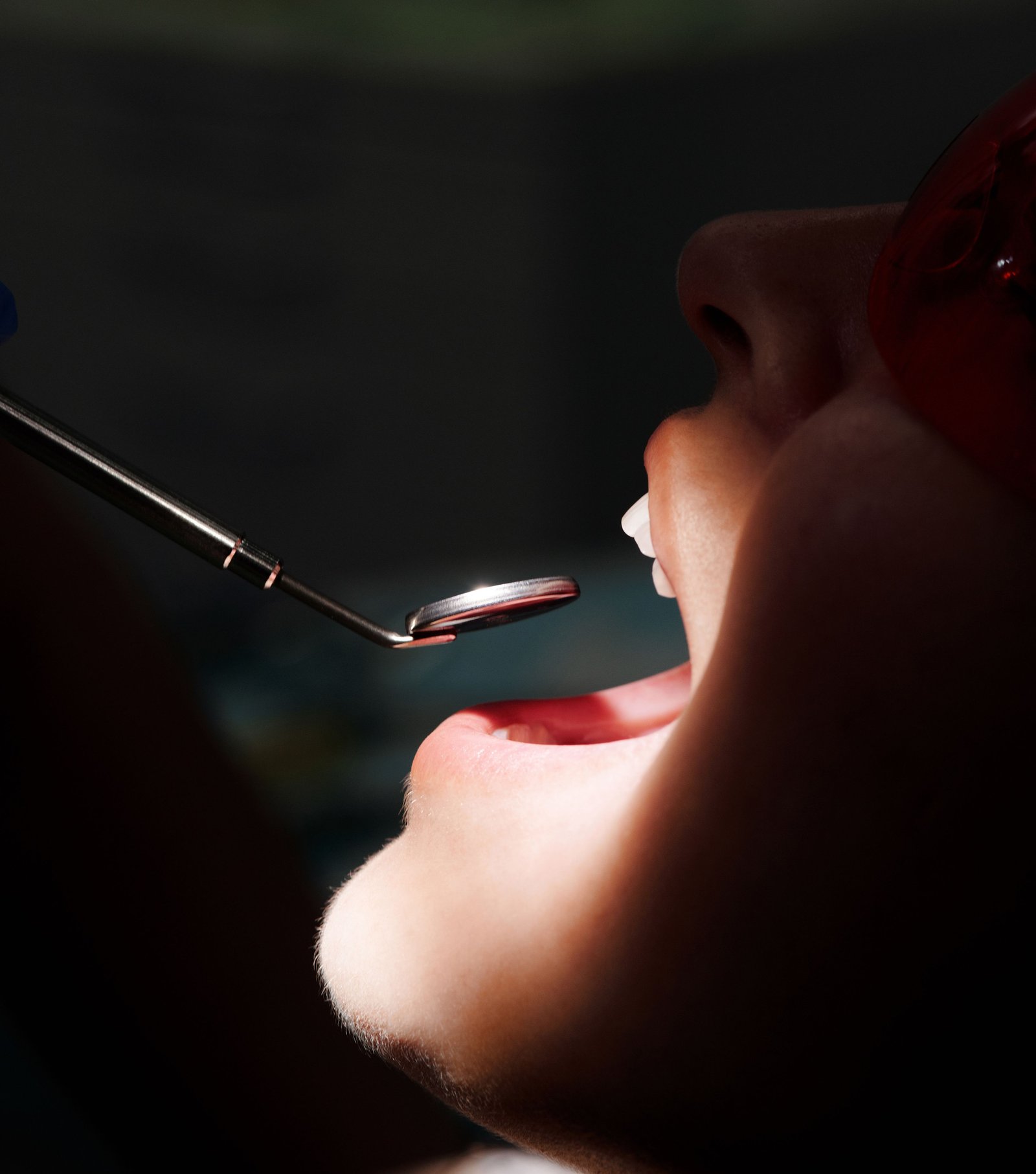 whitening-in-Varanasi