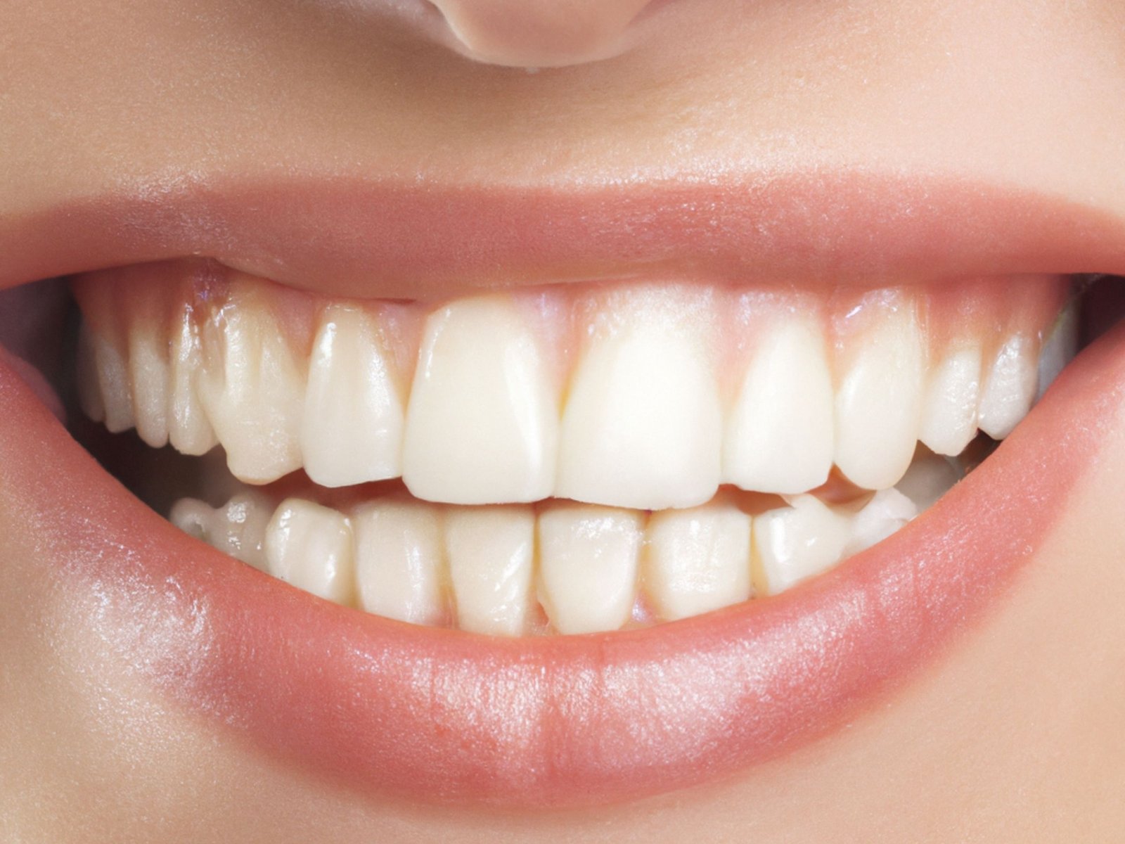 smile-designing-in-varanasi