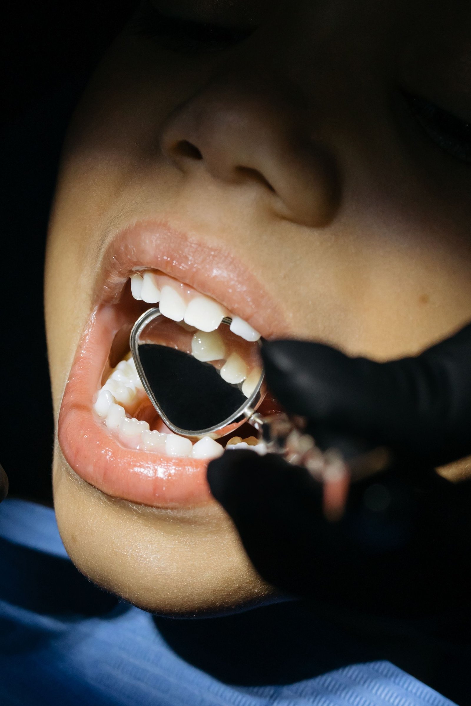 Dental Implants in Varanasi