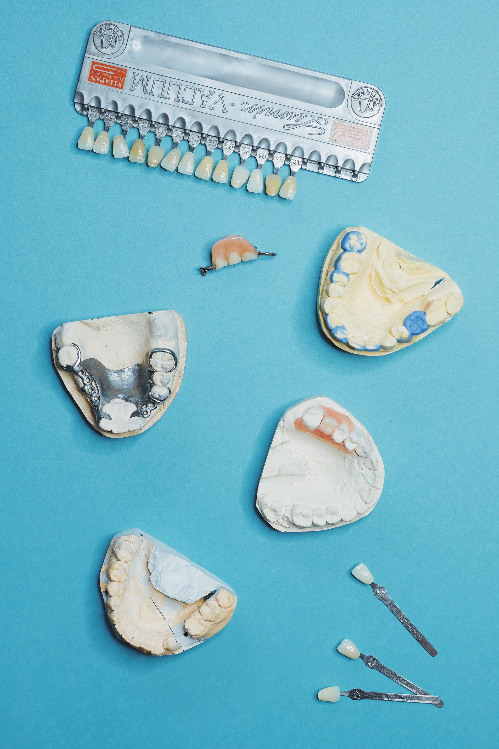 veneers-in-Varanasi