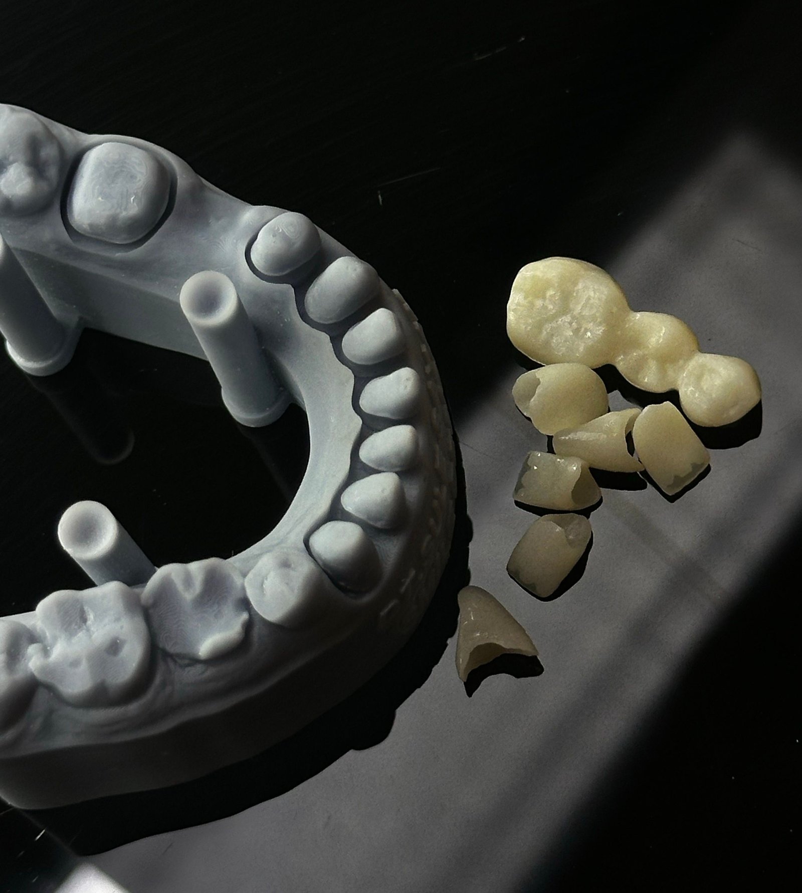 veneers-in-varanasi