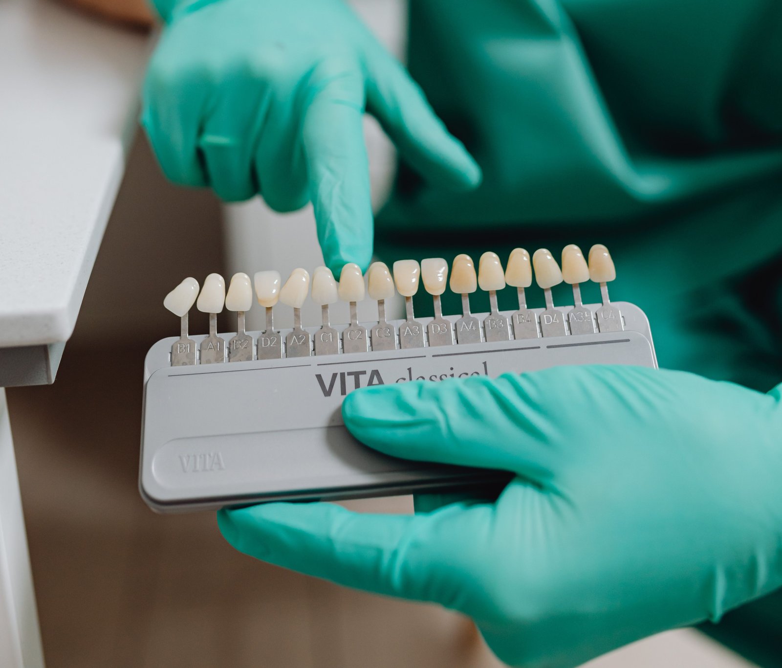 teeth-whitening-in-varanasi